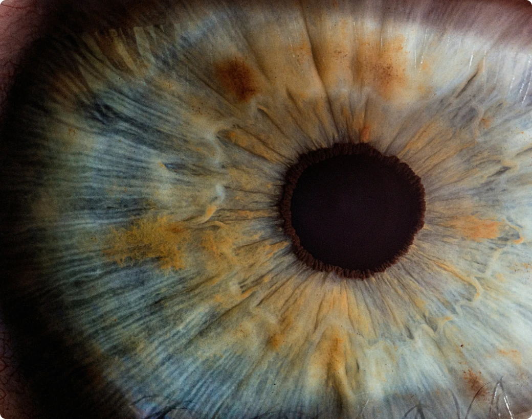 Closeup of eye